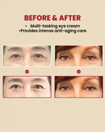 K-Secret Seoul 1988 Eye Cream Retinal Liposome 4% Fermented Bean 30ml