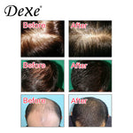 Dexe Hair Building Fibers Black 22g