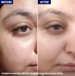 Jenpharm Maxdif Brightening Moisturizer 100ml